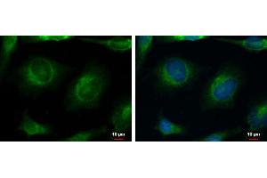 ICC/IF Image CACNB4 antibody [C3], C-term detects CACNB4 protein at cytoplasm by immunofluorescent analysis. (CACNB4 antibody  (C-Term))