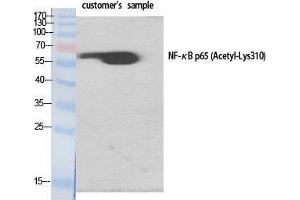 Western Blot (WB) analysis of specific cells using Acetyl-NFkappaB-p65 (K310) Polyclonal Antibody.