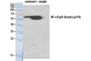 Western Blot (WB) analysis of specific cells using Acetyl-NFkappaB-p65 (K310) Polyclonal Antibody. (NF-kB p65 antibody  (acLys310))