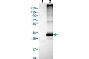 Western blot analysis of Lane 1: Negative control (vector only transfected HEK293T lysate), Lane 2: Over-expression Lysate (Co-expressed with a C-terminal myc-DDK tag (~3. (FITM1 antibody)