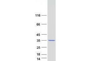 Western Blotting (WB) image for Tumor Protein P63 Regulated 1-Like (TPRG1L) protein (Myc-DYKDDDDK Tag) (ABIN2734098)