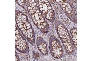 Immunohistochemical staining of human rectum with CHMP4B polyclonal antibody  shows strong granular cytoplasmic positivity in glandular cells. (CHMP4B antibody)