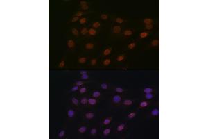 Immunofluorescence analysis of C6 cells using RanG Rabbit mAb (ABIN7269846) at dilution of 1:100 (40x lens). (RANGAP1 antibody)