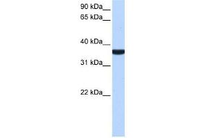 TP53I13 antibody used at 0. (TP53I13 antibody  (C-Term))