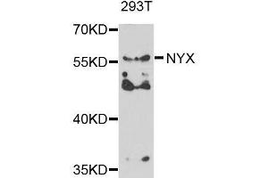 Western blot analysis of extracts of 293T cells, using NYX antibody. (Nyctalopin antibody  (AA 282-481))