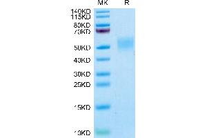 Cynomolgus/Rhesus macaque B7-H4 on Tris-Bis PAGE under reduced condition. (VTCN1 Protein (AA 29-258) (His tag))