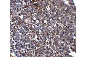 Immunohistochemistry (IHC) image for anti-ORAI Calcium Release-Activated Calcium Modulator 1 (ORAI1) antibody (ABIN1031712) (ORAI1 antibody)