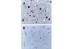 Formalin-fixed, paraffin-embedded human brain sections stained for Active/Cleaved CASP9 expression using CASP9 polyclonal antibody  at 1 : 2000. (Caspase 9 antibody)