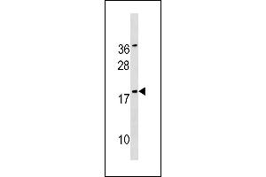 SNX12 Antibody (Center) (ABIN1881820 and ABIN2843219) western blot analysis in  cell line lysates (35 μg/lane). (SNX12 antibody  (AA 84-112))