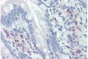 Human Small Intestine (formalin-fixed, paraffin-embedded) stained with CKS1B antibody ABIN337043 at 5 ug/ml followed by biotinylated anti-mouse IgG secondary antibody ABIN481714, alkaline phosphatase-streptavidin and chromogen. (CKS1 antibody  (C-Term))
