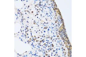 Immunohistochemistry of paraffin-embedded rat lung using MTA3 antibody (ABIN2737194) at dilution of 1:100 (40x lens). (MTA3 antibody)
