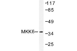 Image no. 1 for anti-Mitogen-Activated Protein Kinase Kinase 6 (MAP2K6) antibody (ABIN265521) (MAP2K6 antibody)