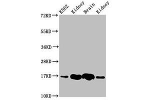 Western Blot Positive WB detected in: K562 whole cell lysate, Rat kideny tissue, Rat brain tissue, Mouse kidney tissue All lanes: HBG2 antibody at 4. (HBG2 antibody  (AA 2-147))