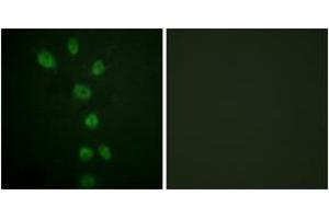 Immunofluorescence analysis of HepG2 cells, using GATA4 (Phospho-Ser105) Antibody. (GATA4 antibody  (pSer105))