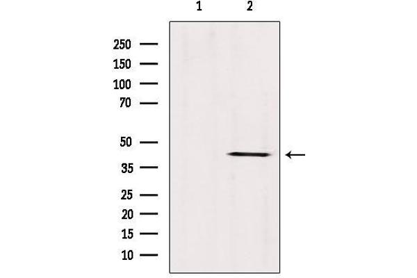 ABHD13 antibody  (Internal Region)
