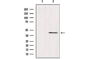 Western blot analysis of extracts from Mouse brain, using ABHD13 Antibody.
