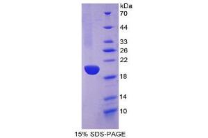 SDS-PAGE (SDS) image for Keratin 13 (KRT13) (AA 266-404) protein (His tag) (ABIN2125540)