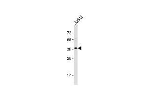 Anti-OR8B8 Antibody (C-term) at 1:1000 dilution + Jurkat whole cell lysate Lysates/proteins at 20 μg per lane.