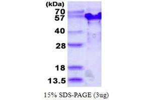 SDS-PAGE (SDS) image for Tumor Suppressing Subtransferable Candidate 4 (TSSC4) (AA 1-329) protein (His tag) (ABIN668006)