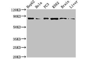 Western Blot Positive WB detected in: HepG2 whole cell lysate, Hela whole cell lysate, PC-3 whole cell lysate, K562 whole cell lyaste, Mouse brain tissue, Rat liver tissue All lanes: STAT4 antibody at 1 μg/mL Secondary Goat polyclonal to rabbit IgG at 1/50000 dilution Predicted band size: 86 kDa Observed band size: 86 kDa (STAT4 antibody  (AA 569-748))