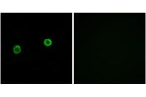 Immunofluorescence analysis of MCF7 cells, using ACOT4 Antibody. (ACOT4 antibody  (AA 361-410))