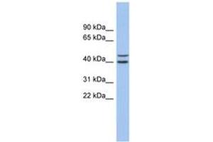 FBXL14 anticorps  (AA 35-84)