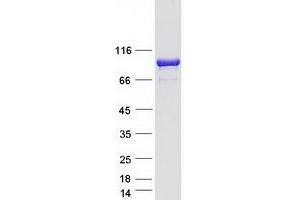 Validation with Western Blot