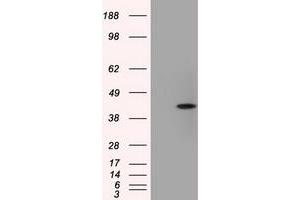 Image no. 3 for anti-Acetyl-CoA Acetyltransferase 2 (ACAT2) antibody (ABIN1496402) (ACAT2 antibody)