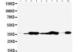 Anti-Annexin V antibody, Western blotting All lanes: Anti Annexin V  at 0. (Annexin V antibody  (Middle Region))