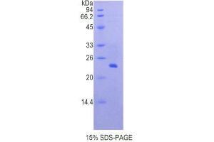 SDS-PAGE (SDS) image for Cathepsin B (CTSB) (AA 129-333) protein (His tag) (ABIN2120765)