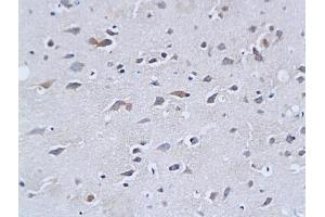 Formalin-fixed and paraffin embedded mouse brain tissue labeled with Rabbit Anti-NF-H/Neurofilament H/Neurofilament 200 Polyclonal Antibody (ABIN672156), Unconjugated followed by conjugation to the secondary antibody and DAB staining (NEFH antibody  (AA 1-100))