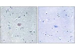 Immunohistochemistry (IHC) image for anti-VEGF Receptor 2 (VEGFR2) (AA 917-966) antibody (ABIN2889081) (VEGFR2/CD309 antibody  (AA 917-966))