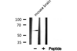 Western blot analysis on mouse brain lysate using Cyclin L1 Antibody (Cyclin L1 antibody  (C-Term))