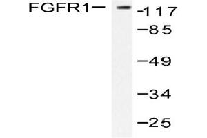 Image no. 1 for anti-Fibroblast Growth Factor Receptor 1 (FGFR1) antibody (ABIN271927) (FGFR1 antibody)