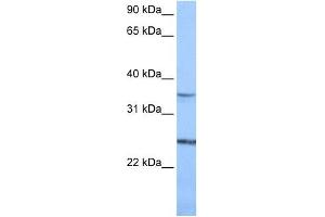 PIGF antibody used at 1 ug/ml to detect target protein. (PIGF antibody  (N-Term))