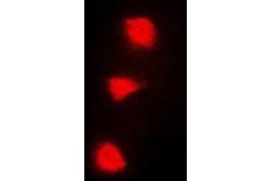 Immunofluorescent analysis of SPZ1 staining in A549 cells. (SPZ1 antibody  (N-Term))