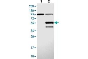 Western blot analysis of Lane 1: Negative control (vector only transfected HEK293T lysate), Lane 2: Over-expression Lysate (Co-expressed with a C-terminal myc-DDK tag (~3. (ABHD2 antibody)