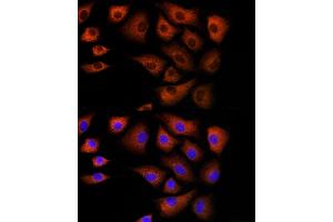 Immunofluorescence analysis of NIH/3T3 cells using DBI Rabbit pAb (ABIN6127407, ABIN6139420, ABIN6139422 and ABIN6217234) at dilution of 1:100 (40x lens). (Diazepam Binding Inhibitor antibody  (AA 1-114))