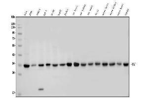 Western blot analysis of MCU using anti-MCU antibody (ABIN7601931). (MCU antibody  (AA 51-351))