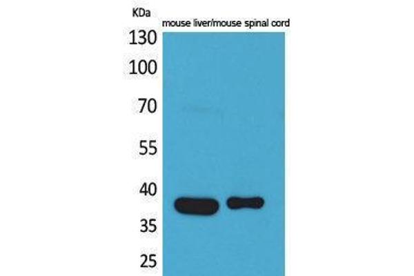 ALDOC antibody  (N-Term)