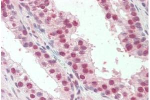 Human Prostate: Formalin-Fixed, Paraffin-Embedded (FFPE) (Homeobox D13 antibody  (AA 256-269))