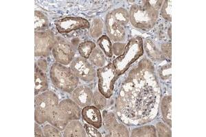 Immunohistochemical staining of human kidney with ZC3H12A polyclonal antibody  shows strong cytoplasmic positivity in cells in tubules at 1:200-1:500 dilution. (ZC3H12A antibody)