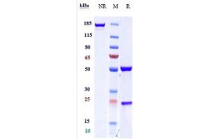 Anti-CD163 Reference Antibody (OR2805) on SDS-PAGE under reducing (R) condition.