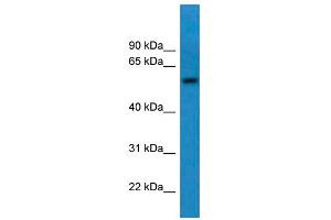 WB Suggested Anti-CNDP1 Antibody Titration: 0. (CNDP1 antibody  (C-Term))