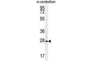 VSTM2A Antibody (Center) western blot analysis in mouse cerebellum tissue lysates (35 µg/lane). (VSTM2A antibody  (Middle Region))