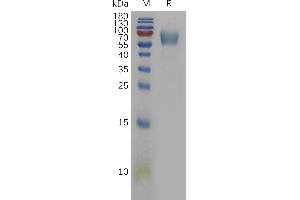 Interleukin 18 Binding Protein (IL18BP) (AA 31-194) protein (Fc Tag)