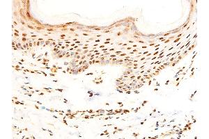 ABIN6267304 at 1/100 staining human skin tissue sections by IHC-P.