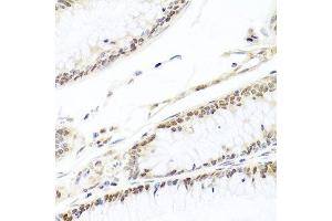 Immunohistochemistry (Paraffin-embedded Sections) (IHC (p)) image for anti-HIR Histone Cell Cycle Regulation Defective Homolog A (HIRA) (AA 250-550) antibody (ABIN6141776)