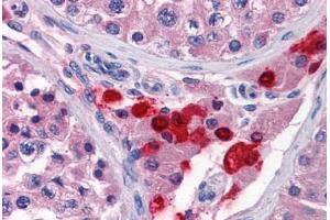 Human Testis: Formalin-Fixed, Paraffin-Embedded (FFPE) (TWIST2 antibody  (AA 1-161))