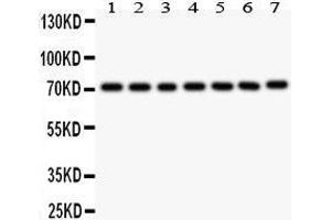 Anti- FOXO3A antibody, Western blotting All lanes: Anti FOXO3A  at 0. (FOXO3 antibody  (AA 471-673))